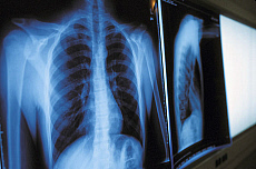 Quality stock photography from estockphoto of x ray examination
